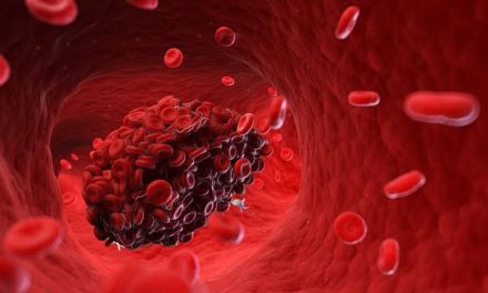 Every coronavirus-infected patient who dies has ‘very clear’ evidence of blood-clotting, top scientist claims