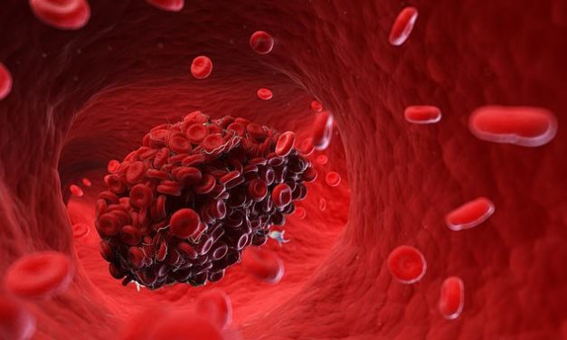Every coronavirus-infected patient who dies has ‘very clear’ evidence of blood-clotting, top scientist claims