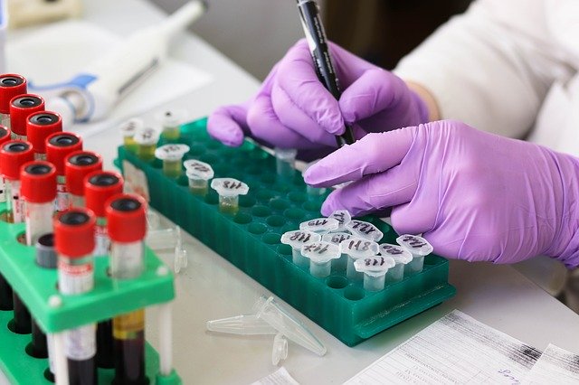 STEP CLOSER: Roche antibody test that’s 100% accurate approved in breakthrough that could help ease UK coronavirus lockdown